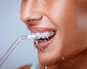 Whats the deal with water flossers?