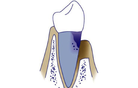 https://mainstreetdental.com.au/wp-content/uploads/2021/01/Image-3-1-3.png