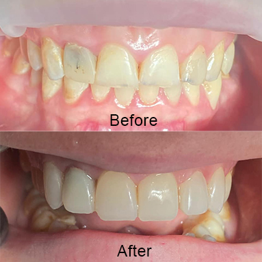 https://mainstreetdental.com.au/wp-content/uploads/2024/01/img5.jpg