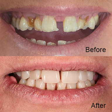 https://mainstreetdental.com.au/wp-content/uploads/2024/01/img6.jpg